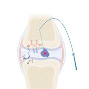 graphical abstract